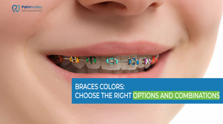 Braces Colors - Choose the Right Options and Combinations