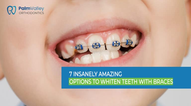 Child smiling with clean and white teeth while wearing braces