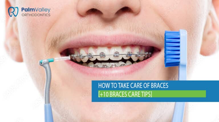 Teen boy brushing braces for proper dental hygiene and oral care.