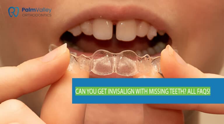 Close-up of a smiling mouth with a missing tooth and clear Invisalign aligners, illustrating the possibility of Invisalign treatment for patients with missing teeth.